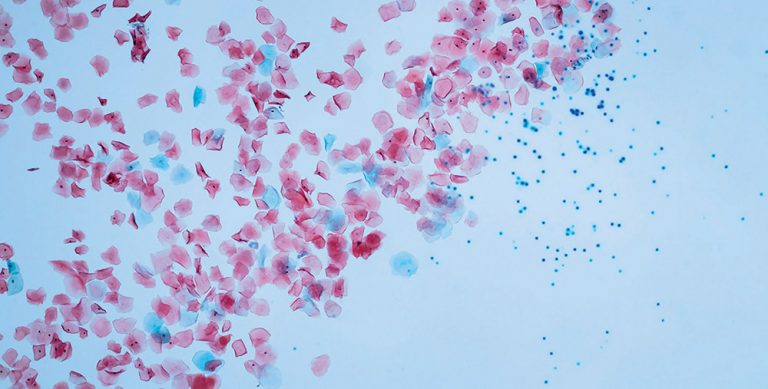 Microplastics in water